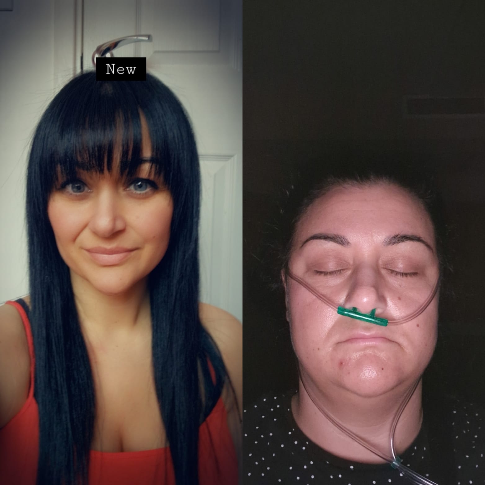 gastric sleeve in turkey